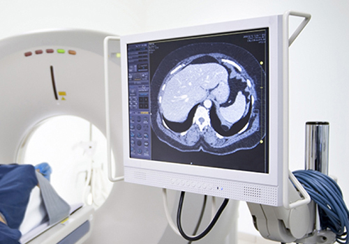 為什么IPS顯示技術(shù)應(yīng)用于診斷顯示器？